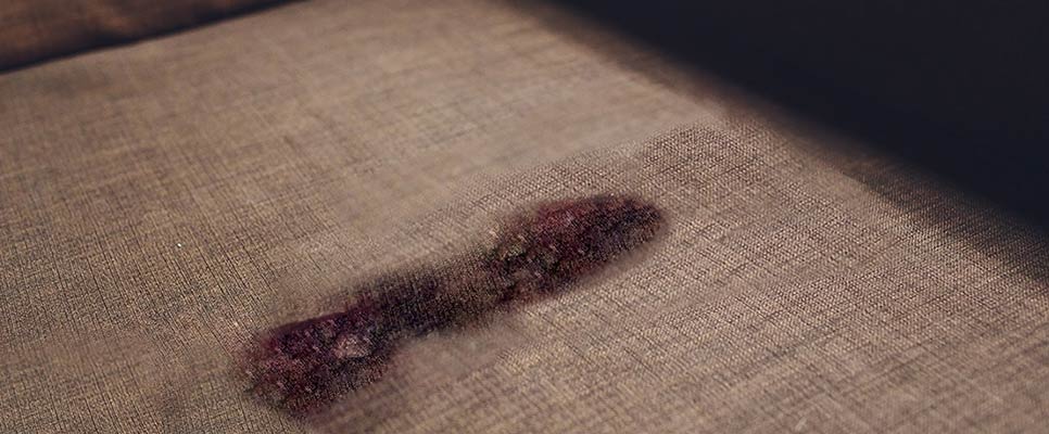 Can Baking Soda Remove Dried Blood Stains From The Upholstery